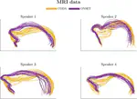 A battle of articulatory methods for the study of English /l/: UTI vs MRI