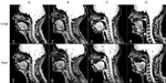Phonetic accuracy in French learners of English: towards a bilingual database combining articulatory MRI and audio